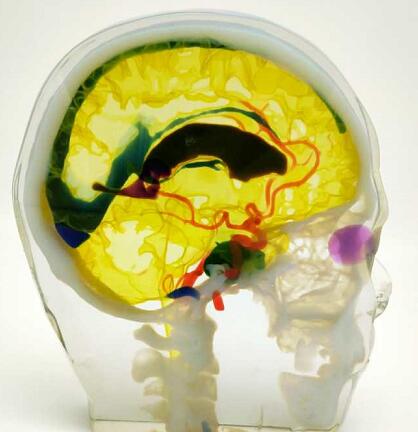 3D打印全彩軟性透明樹脂醫療模型